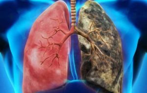 healthy and unhealthy lungs, smoke, e-cigarette