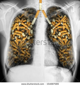 lungs full of cigarette-smoking - x ray of Human